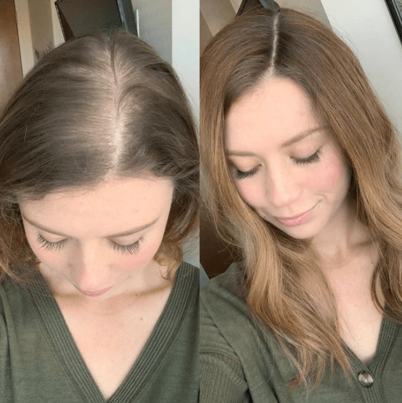 Brosse de Massage  Capillaire avec Lumière Rouge