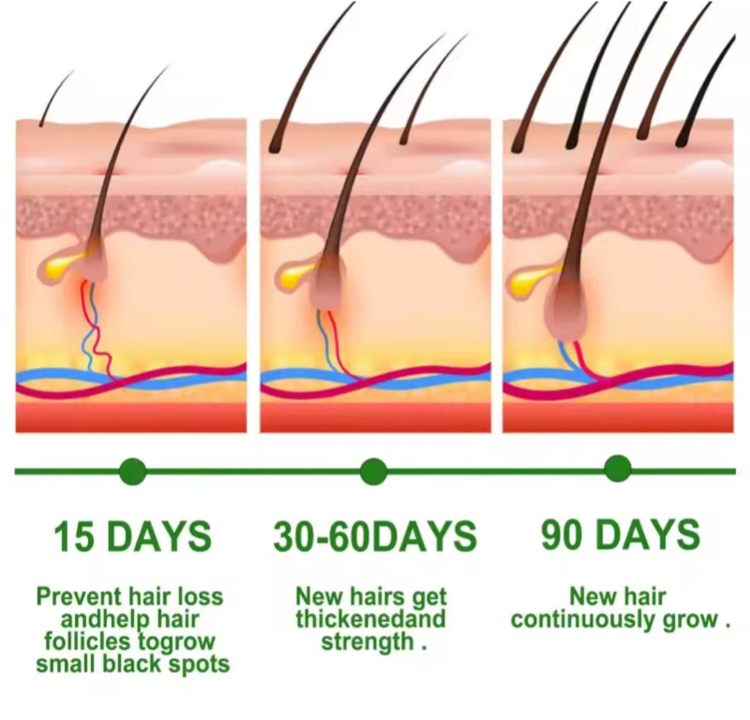 L'huile essentiels de romarin